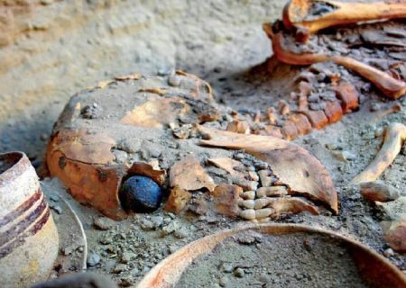 چشم مصنوعی در بهترین حالت نگهداری ماند