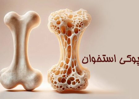 تغذیه سالم، راهی برای پیشگیری از پوکی استخوان